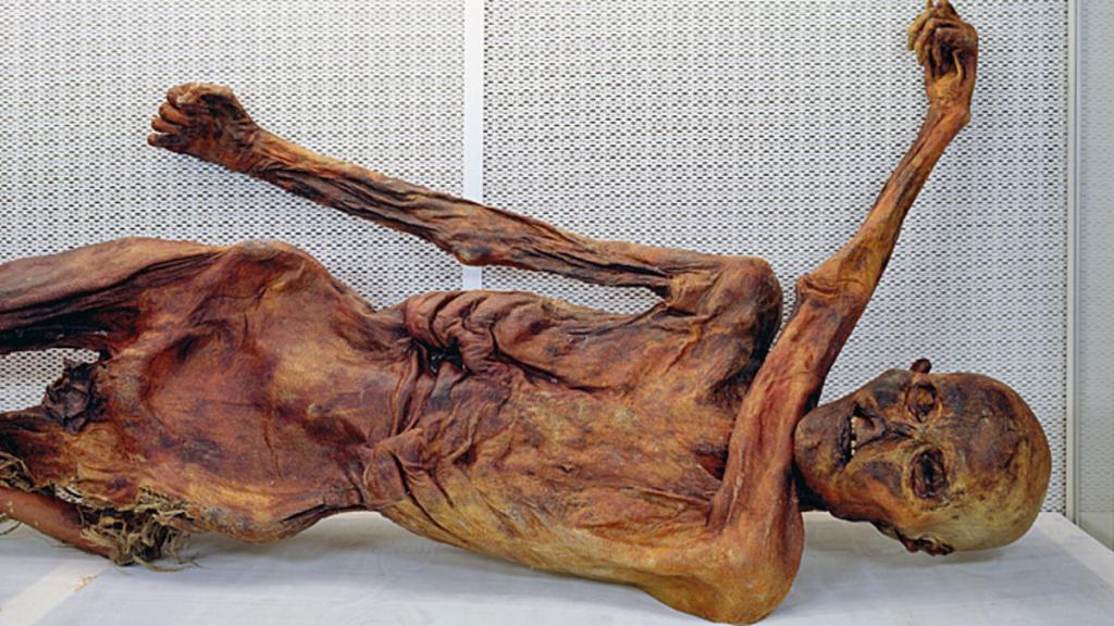 Ötzi